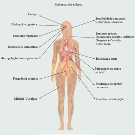Sintomas da síndrome da fádiga crônica