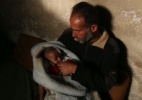 Campanha tenta salvar bebê que perdeu olho em ataque na Síria - BBC