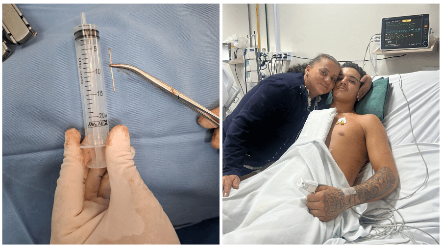 Jovem sobrevive após disparar prego no próprio coração em SC