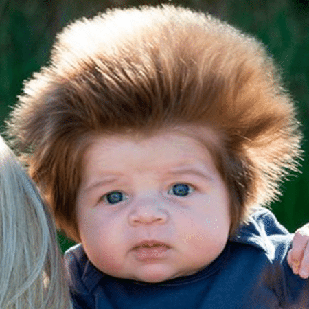 Você conhece o bebê mais cabeludo do mundo? Ele tem apenas dois meses! - Divulgação