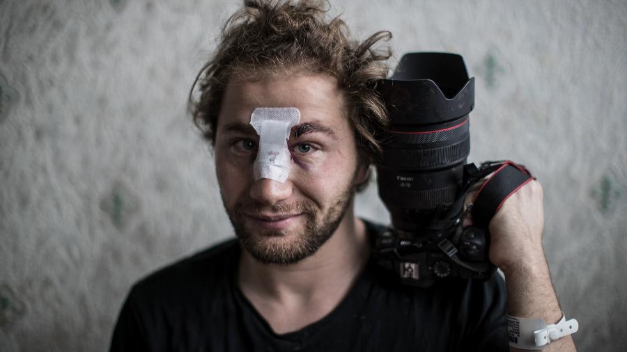 30.nov.2020 - O fotógrafo sírio Ameer al-Halbi, de 24 anos, ferido durante confrontos em uma manifestação contra o projeto de lei de segurança global em Paris - SAMEER AL-DOUMY / AFP