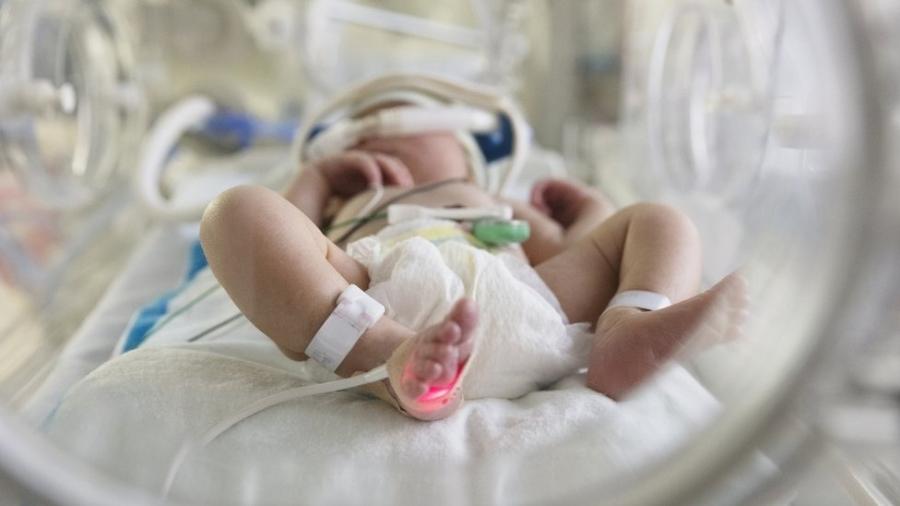 Desde início da pandemia, 420 bebês (crianças com menos de 1 ano) morreram em decorrência do novo coronavírus no Brasil, contra 45 nos Estados Unidos - Getty Images