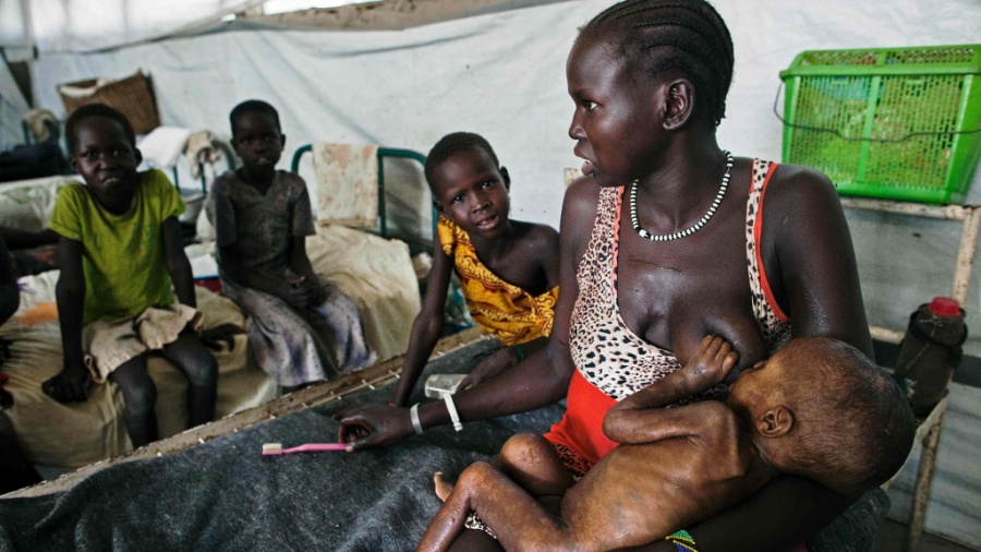 Mulher amamenta filho com grave desnutrição em clínica africana - AFP/cds/Albert Gonzalez Farran org