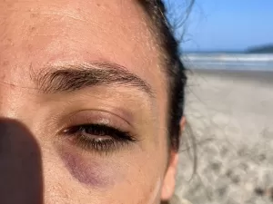 Instrutor de surf é suspeito de agredir mulher no litoral norte de SP
