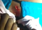 Jovem grávida é ferida por tiro em ocupação do MTST em Aracaju - Reprodução