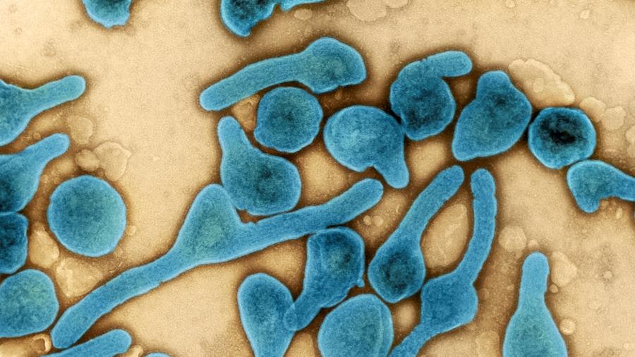 Vírus da família do ebola causou surto na Tanzânia - Reprodução/Wikimedia Commons