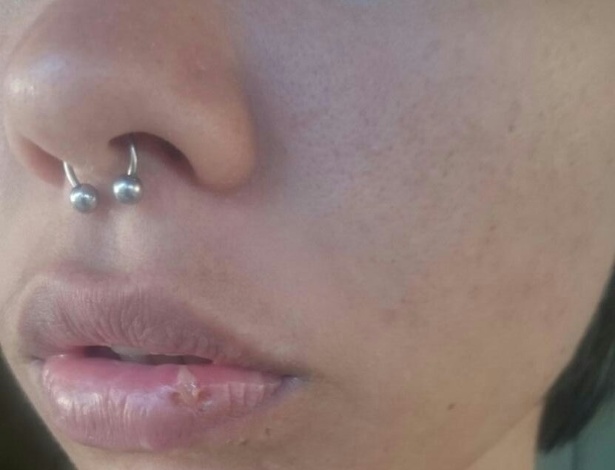 Taíse Cristina Roberta de Oliveira, 24, mostra o lábio cortado após levar um soco de um conhecido. Ela o acusa de homofobia - Arquivo pessoal