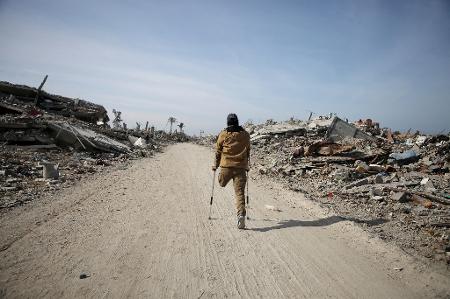 Palestino que perdeu a perna volta para casa no norte da Faixa de Gaza