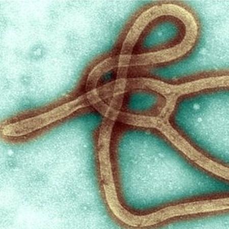Vírus do ebola - Getty Images  - Getty Images 