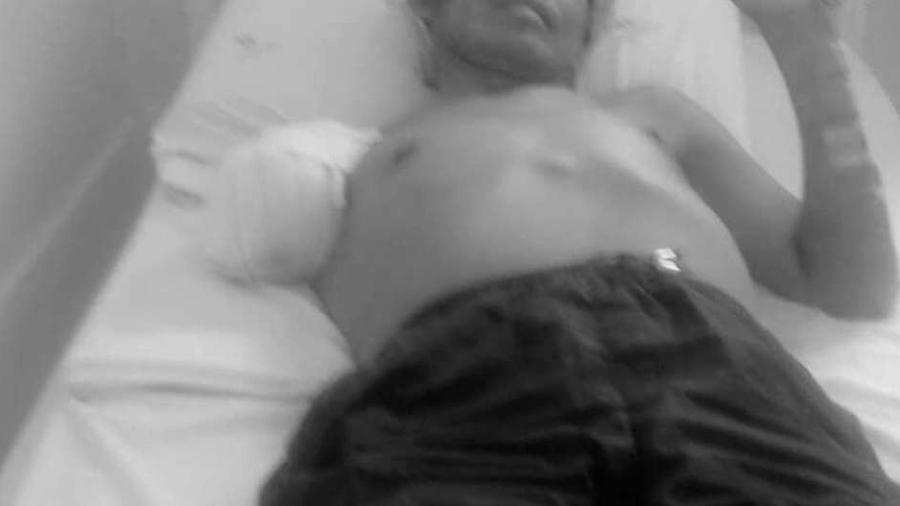 Índio da etnia pareci no hospital com ferimentos e um dos braços amputado - Facebook/Reprodução/Estadão