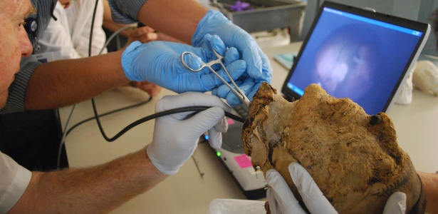 Grupo de médicos do Hospital Geral de Massachusetts extraiu dente da cabeça mumificada em 2009 - Museum of Fine Arts, Boston via The New York Times - Museum of Fine Arts, Boston via The New York Times