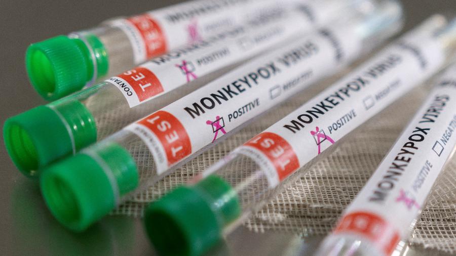 Tubos de ensaio rotulados como vírus de varíola de macaco com resultado positivo - CDC/via REUTERS