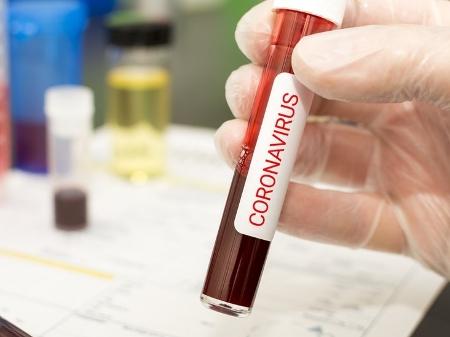 Coronavírus: Segunda morte do Brasil é confirmada no Rio de Janeiro