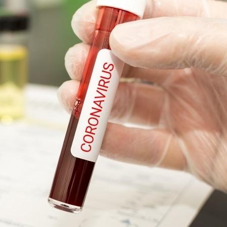 Teste para a detecção do novo coronavírus - Getty Images