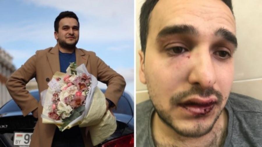 Maksim Khoroshyn antes e depois das agressões - BBC