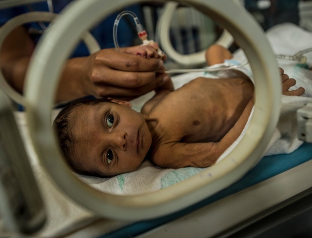 Esteban Granadillo, 18 dias de vida, que pesa 1,8 quilos, no Hospital Universitário de Pediatria Dr. Agustín Zubillaga em Barquisimeto, na Venezuela - MERIDITH KOHUT/NYT