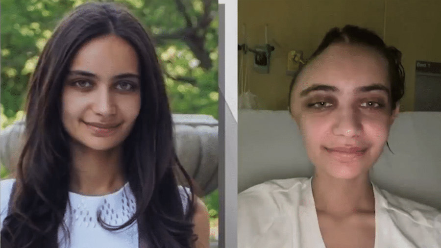 Annabel Sel antes e depois de acidente em que foi atingida por cadeira em NY - Reprodução/NBC