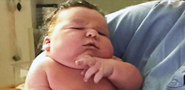 Menino nasceu com incríveis 7,2 kg, mas teve problemas respiratórios e de alimentação - Reprodução