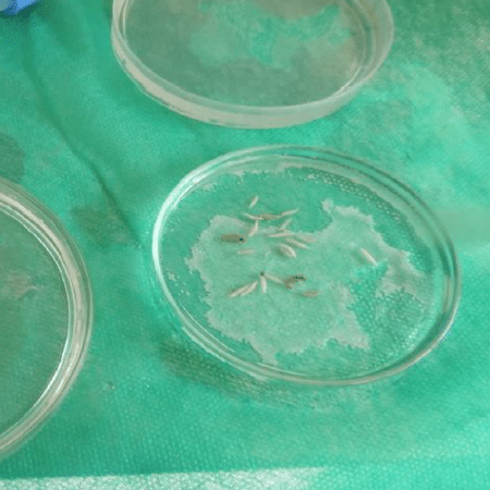 Larvas revelam DNA de sêmen que havia se perdido em corpo em putrefação, diz pesquisadora - 