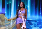 Miss Universo teve 1ª candidata com vitiligo; como a doença se manifesta? - Reprodução/Instagram