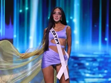 Miss Universo teve 1ª candidata com vitiligo; como a doença se manifesta?