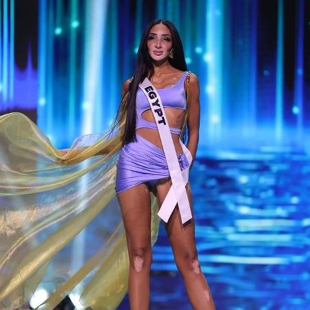 Miss Universo teve pela 1ª vez candidata com vitiligo, Logina Salah