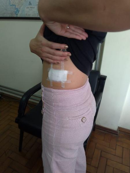 A atriz Thaís Campos foi atingida por bala de borracha da PM na dispersão de bloco em SP - Ana Carla Bermúdez/UOL