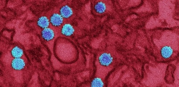 Imagem ampliada e detalhada do vírus da zika  - Reprodução/BBC