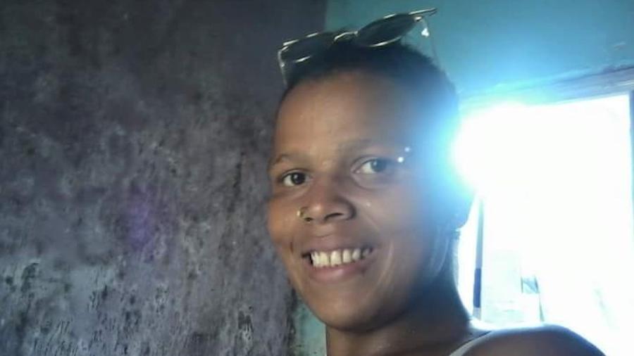 A diarista Angélica Rodrigues, 26, ficou com queimaduras graves em 85% do corpo após tentar cozinhar com álcool  - Arquivo Pessoal