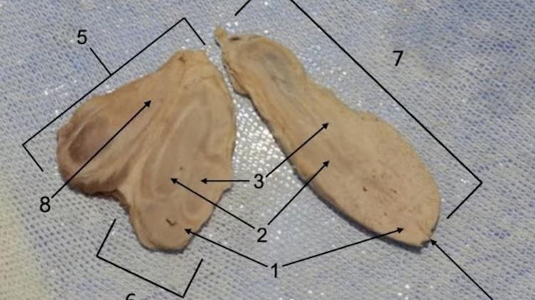 Corte longitudinal do pênis primário (7), secundário (6) e terciário (5)