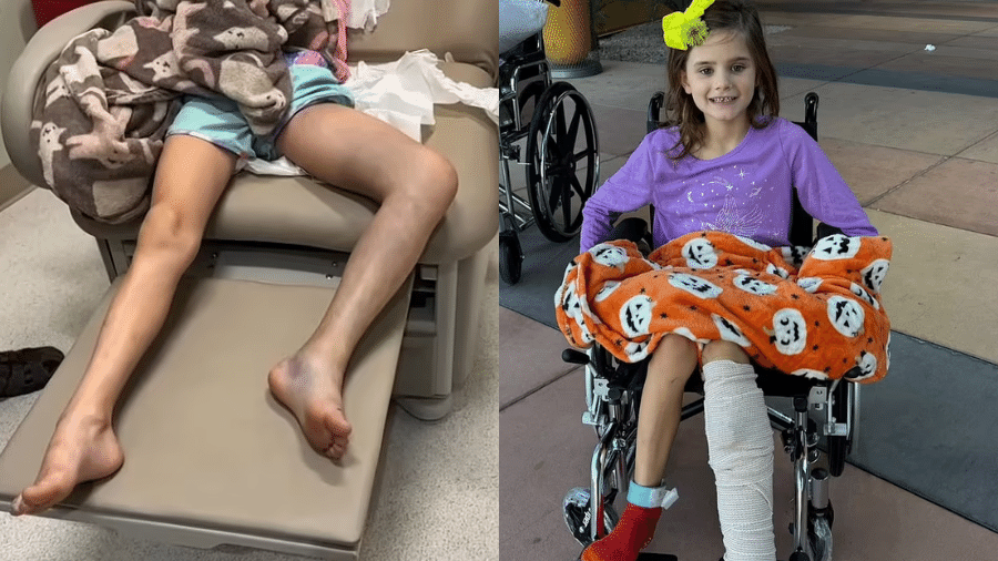 Allie Brasfield, 7, passou mais de 30 horas com veneno de cascavel no corpo