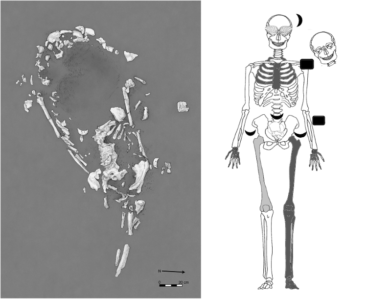 Esquema dos ossos da grávida encontrada no Equador junto ao crânio de outra vítima Esquema dos ossos da grávida encontrada no Equador junto ao crânio de outra vítima