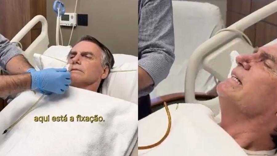 Bolsonaro tirou a sonda nasogástrica hoje; ele continua internado na UTI após cirurgia, mas começou a ingerir líquidos Bolsonaro tirou a sonda nasogástrica hoje; ele continua internado na UTI após cirurgia, mas começou a ingerir líquidos