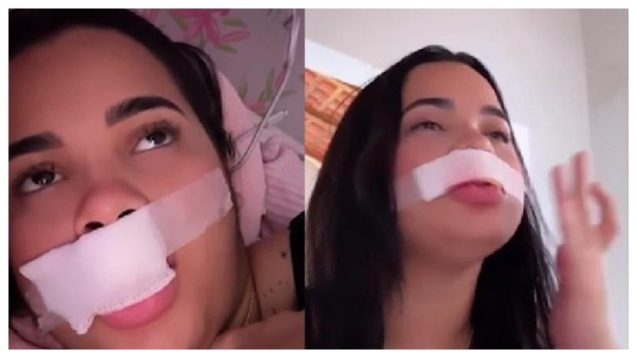 Eryka Costa precisará passar por procedimento de reconstrução do lábio