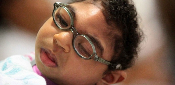 3.nov,2016 - Bebês com microcefalia receberam óculos da Fundação Altino Ventura, no Recife - Marlon Costa/Futura Press/Estadão Conteúdo
