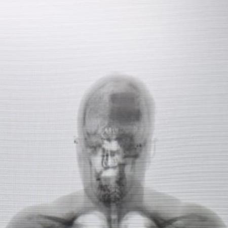 Mancha escura na cabeça da visitante revelada pelo scanner corporal indicou local onde celulares estavam escondidos