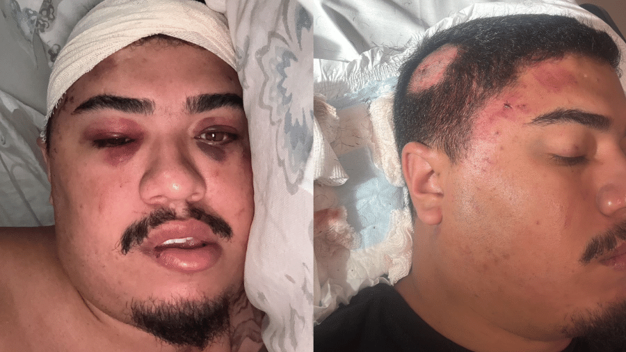 Pedro Jordão foi espancado na saída de uma boate na Lagoa, Zona Sul do Rio Pedro Jordão foi espancado na saída de uma boate na Lagoa, Zona Sul do Rio