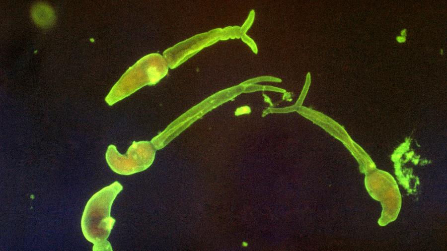 Cercárias de Schistosoma mansoni Cercárias de Schistosoma mansoni