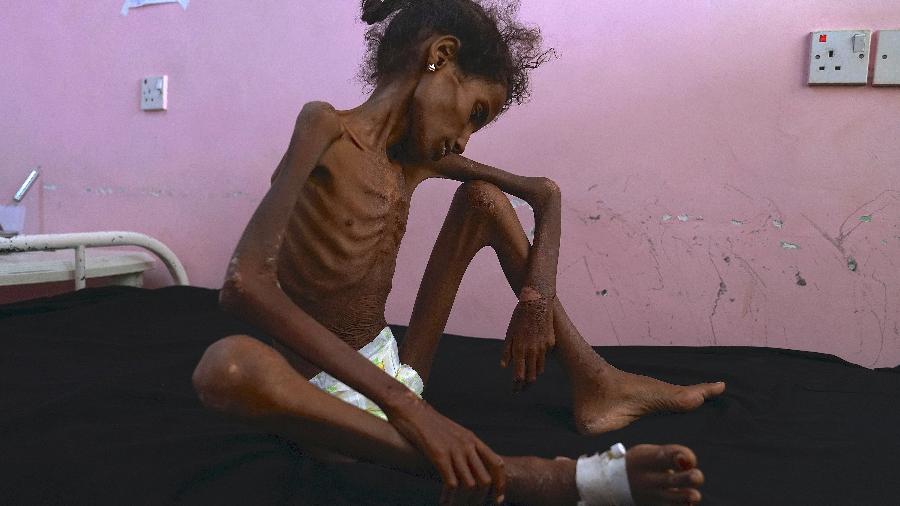 Abrar Ibrahim, 12, pesa 28 quilos e está internada no Hospital Al Sadaqa, em Aden, Iêmen - Giles Clarke/The New York Times