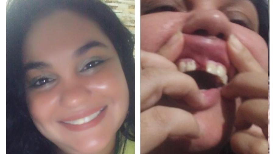 Cantora relata erro odontológico em clínica de Cubatão - Arquivo Pessoal