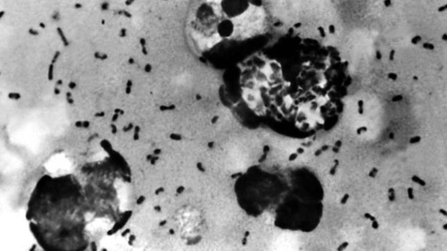 Uma amostra de peste bubônica em tecido removido do gânglio de um paciente - Getty Images