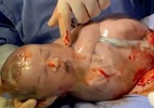 Empelicado: Médico rompe bolsa amniótica em vídeo que emocionou as redes - Instagram/reprodução