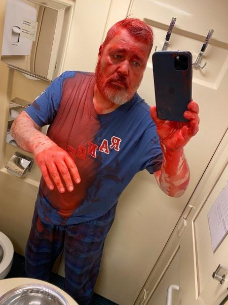 Dmitry Muratov mostra como ficou após ser atingido por tinta em foto no banheiro do trem - Reprodução - 7.abr.22