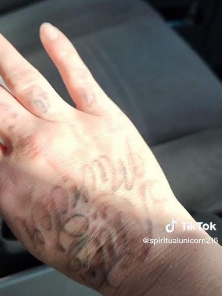 Ex-convict who went viral with his tattoos started laser removal - spiritüelunicorn216/TikTok - spiritüelunicorn216/TikTok
