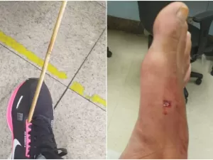 Mulher é atingida por flecha de 60 cm no pé em Belo Horizonte 