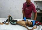 Enfermeira que atuou em Gaza teme mais mortes por fome e critica bloqueio