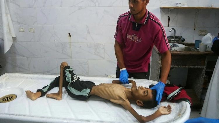 Médico de hospital em Khan Yunis, Sul da Faixa de Gaza, limpa o corpo do palestino Abdul Jawad al-Ghalban, de 14 anos, que morreu de fome
