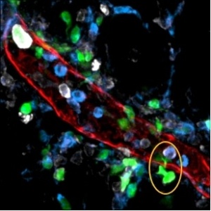 Mudança nas células leva a quadro de inflamação crônica - Divulgação/Agência Fapesp