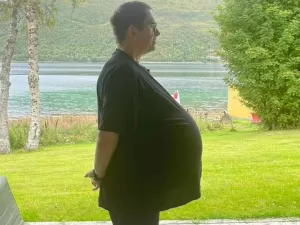 Homem tratado como obseso e com Ozempic descobre tumor de 27 kg na barriga