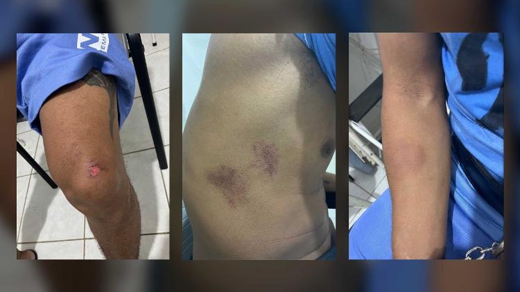 Exames do IML indicam lesões no corpo de Rogério da Silva Mendonça, um dos fugitivos de Mossoró, após recaptura